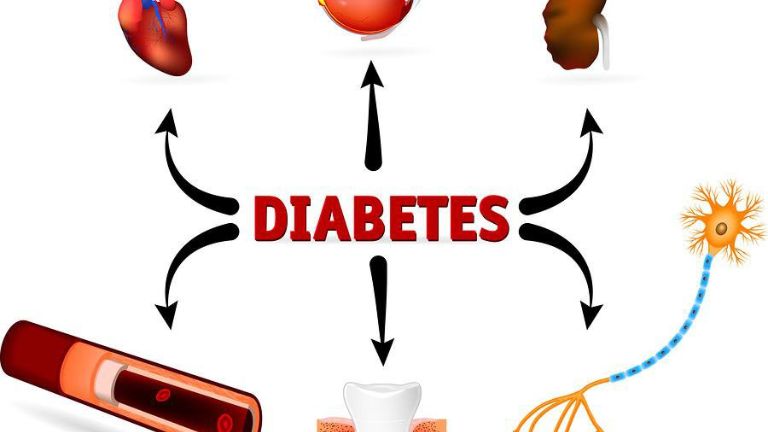 Hạt điều nướng trị tốt bệnh tiểu đường mức 2